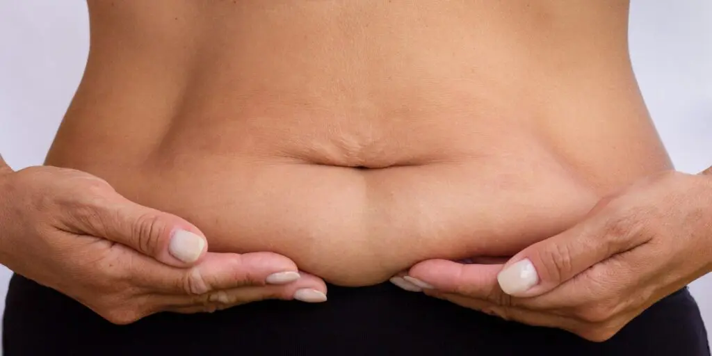 Person holding a fold of loose belly skin after weight loss
